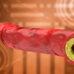cholesterol